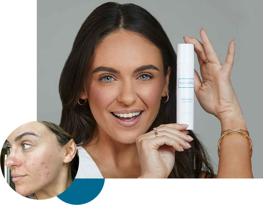 acne clinic evansville in