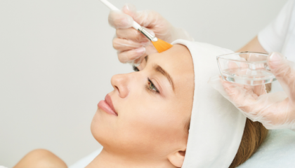 chemical peels in Evansville Indiana