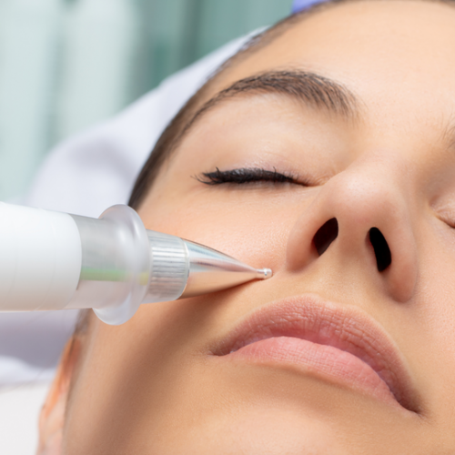 plasma lift skin tightening in Evansville IN