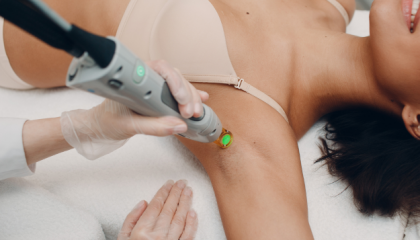 laser hair removal evansville indiana